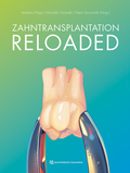 Bild: Zahntransplantation Reloaded - Quintessenz Verlag
