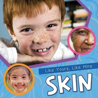 Enlarge image Cover: Skin - Kidhaven Publishing