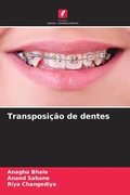 Cover: Transposicao de dentes - Edicoes Nosso Conhecimento