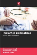 Cover: Implantes zigomaticos - Edicoes Nosso Conhecimento