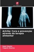 Cover: Artrite - Edicoes Nosso Conhecimento