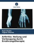 Cover: Arthritis - Verlag Unser Wissen