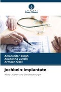 Cover: Jochbein-Implantate - Verlag Unser Wissen