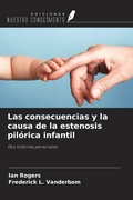 Cover: Las consecuencias y la causa de la estenosis pil&oacute;rica infantil - Ediciones Nuestro Conocimiento