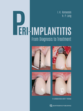 Cover: Peri-Implantitis - Quintessenz Verlag