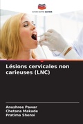 Cover: L&eacute;sions cervicales non carieuses (LNC) - Editions Notre Savoir