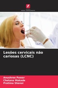 Cover: Les&otilde;es cervicais n&atilde;o cariosas (LCNC) - Edi&ccedil;&otilde;es Nosso Conhecimento