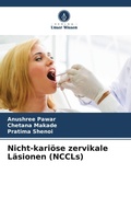 Cover: Nicht-kari&ouml;se zervikale L&auml;sionen (NCCLs) - Verlag Unser Wissen