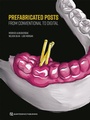 Cover: Prefabricated Posts - Quintessenz Verlag