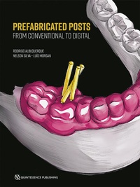 Enlarge image Cover: Prefabricated Posts - Quintessenz Verlag