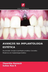 Enlarge image Cover: AVANÇOS NA IMPLANTOLOGIA ESTÉTICA - Edições Nosso Conhecimento