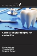Cover: Caries: un paradigma en evoluci&oacute;n - Ediciones Nuestro Conocimiento