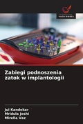 Cover: Zabiegi podnoszenia zatok w implantologii - Wydawnictwo Nasza Wiedza