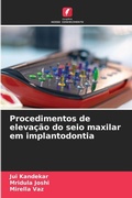 Cover: Procedimentos de elevacao do seio maxilar em implantodontia - Edicoes Nosso Conhecimento