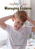 Cover: Managing Eczema - Mitchell Lane Publishers
