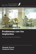 Cover: Problemas con los implantes - Ediciones Nuestro Conocimiento