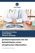Cover: Jochbeinimplantate bei der Rehabilitation eines atrophischen Oberkiefers - Verlag Unser Wissen