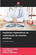 Cover: Implantes zigomaticos na reabilitacao de maxilas atroficas - Edicoes Nosso Conhecimento