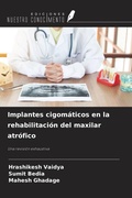 Cover: Implantes cigom&aacute;ticos en la rehabilitaci&oacute;n del maxilar atr&oacute;fico - Ediciones Nuestro Conocimiento