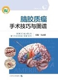 Cover: Surgical Techniques and Atlas of Brain Glioma Surgery/??????????? - China National Publications Import & Export C