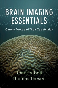 Enlarge image Cover: Brain Imaging Essentials - Cambridge University Press