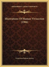 Abbildung von: Illustrations Of Human Vivisection (1906) - Kessinger Publishing