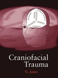 Abbildung von: Craniofacial Trauma - Oxford University Press