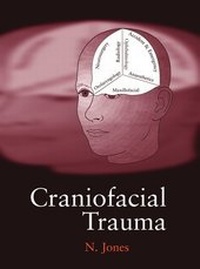 Abbildung von: Craniofacial Trauma - Oxford University Press