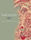 Cover: Vasculitis - Oxford University Press