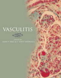 Enlarge image Cover: Vasculitis - Oxford University Press