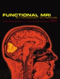 Cover: Functional Magnetic Resonance Imaging - Oxford University Press