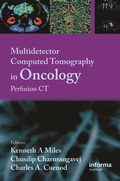 Cover: Multi-Detector Computed Tomography in Oncology - CRC Press
