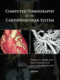 Abbildung von: Computed Tomography of the Cardiovascular System - CRC Press