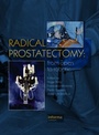Cover: Radical Prostatectomy - CRC Press
