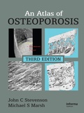 Cover: An Atlas of Osteoporosis - CRC Press