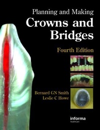 Abbildung von: Planning and Making Crowns and Bridges - CRC Press