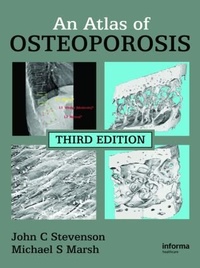 Abbildung von: An Atlas of Osteoporosis - CRC Press