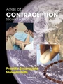 Cover: Atlas of Contraception - CRC Press