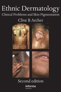 Cover: Ethnic Dermatology - CRC Press