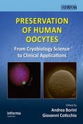 Bild: Preservation of Human Oocytes - CRC Press