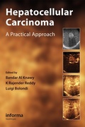 Cover: Hepatocellular Carcinoma - CRC Press