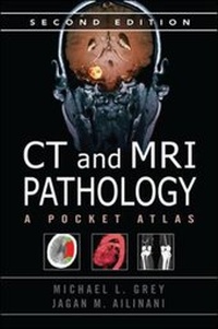 Enlarge image Cover: CT & MRI Pathology: A Pocket Atlas, Second Edition - McGraw-Hill Medical