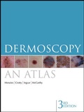 Cover: Dermoscopy - McGraw-Hill Education / Australia