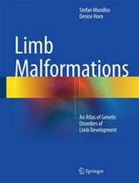 Abbildung von: Limb Malformations - Springer