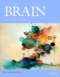 Abbildung von: Brain - Oxford University Press