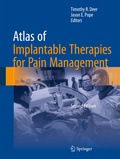 Cover: Atlas of Implantable Therapies for Pain Management - Springer