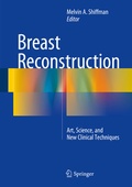 Cover: Breast Reconstruction - Springer