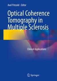 Abbildung von: Optical Coherence Tomography in Multiple Sclerosis - Springer