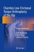 Cover: Charnley Low-Frictional Torque Arthroplasty of the Hip - Springer