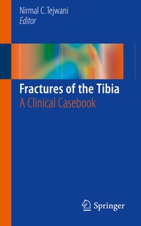 Abbildung von: Fractures of the Tibia - Springer